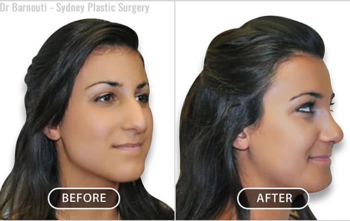 About Dr Jack Zoumaras - Ariste Plastic Surgery