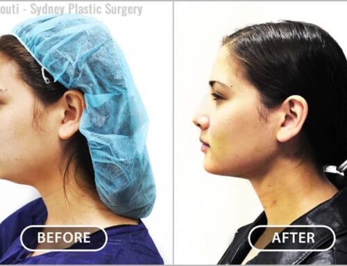 Neck Surgery