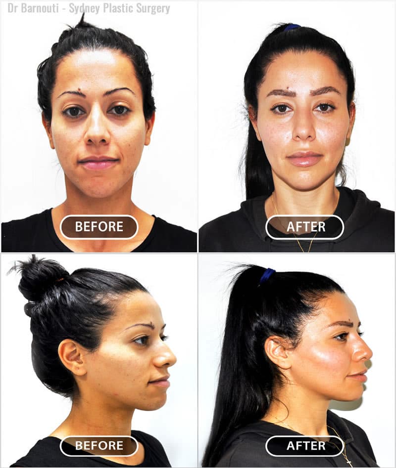 Plastic Surgery in Sydney, Australia - DrGraham Sellars