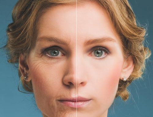 New Screening Rules for People Seeking Cosmetic Surgery and Botox