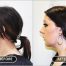 Chin augmentation