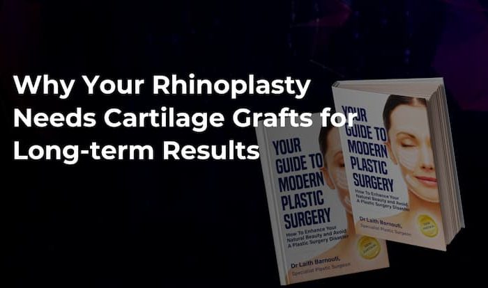 Rhinoplasty Long Term Results